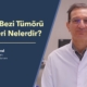 Parotis Bezi Tümörü Belirtileri Nelerdir? - Prof. Dr. Çetin Vural