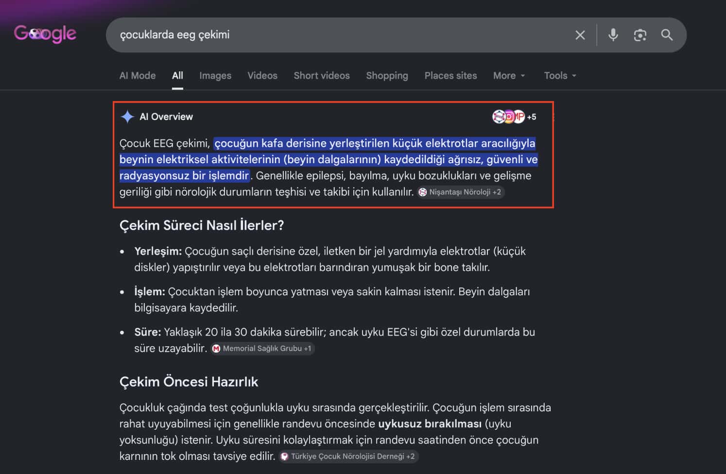 Çocuklarda EEG Çekimi | e-Klinik