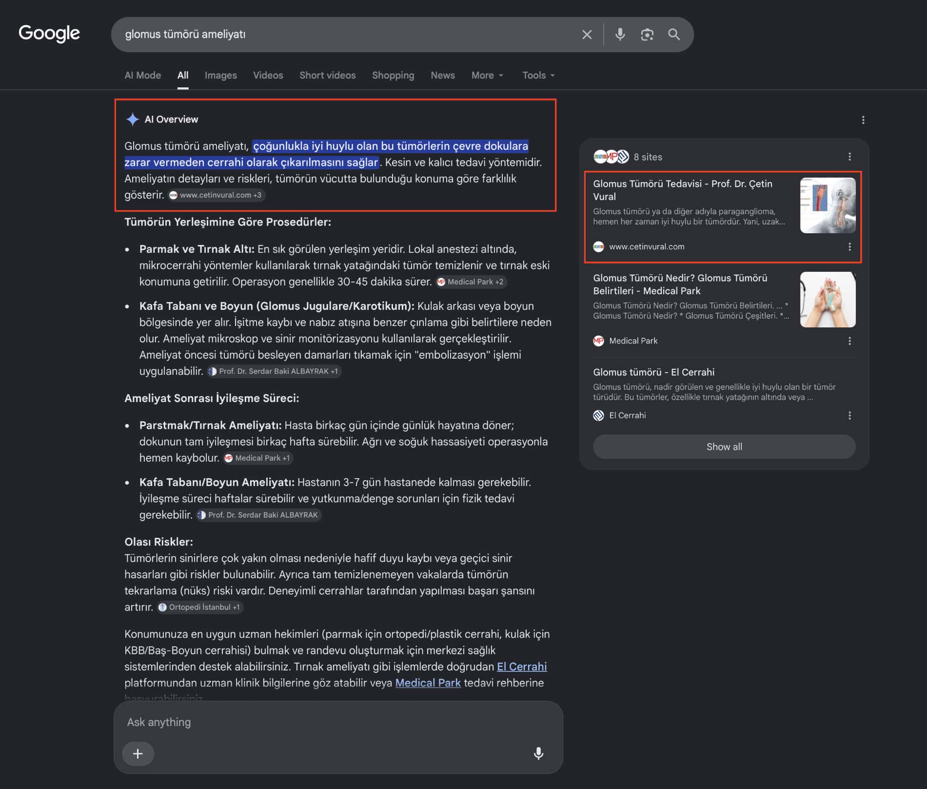 Glomus Tümörü Ameliyatı | e-Klinik