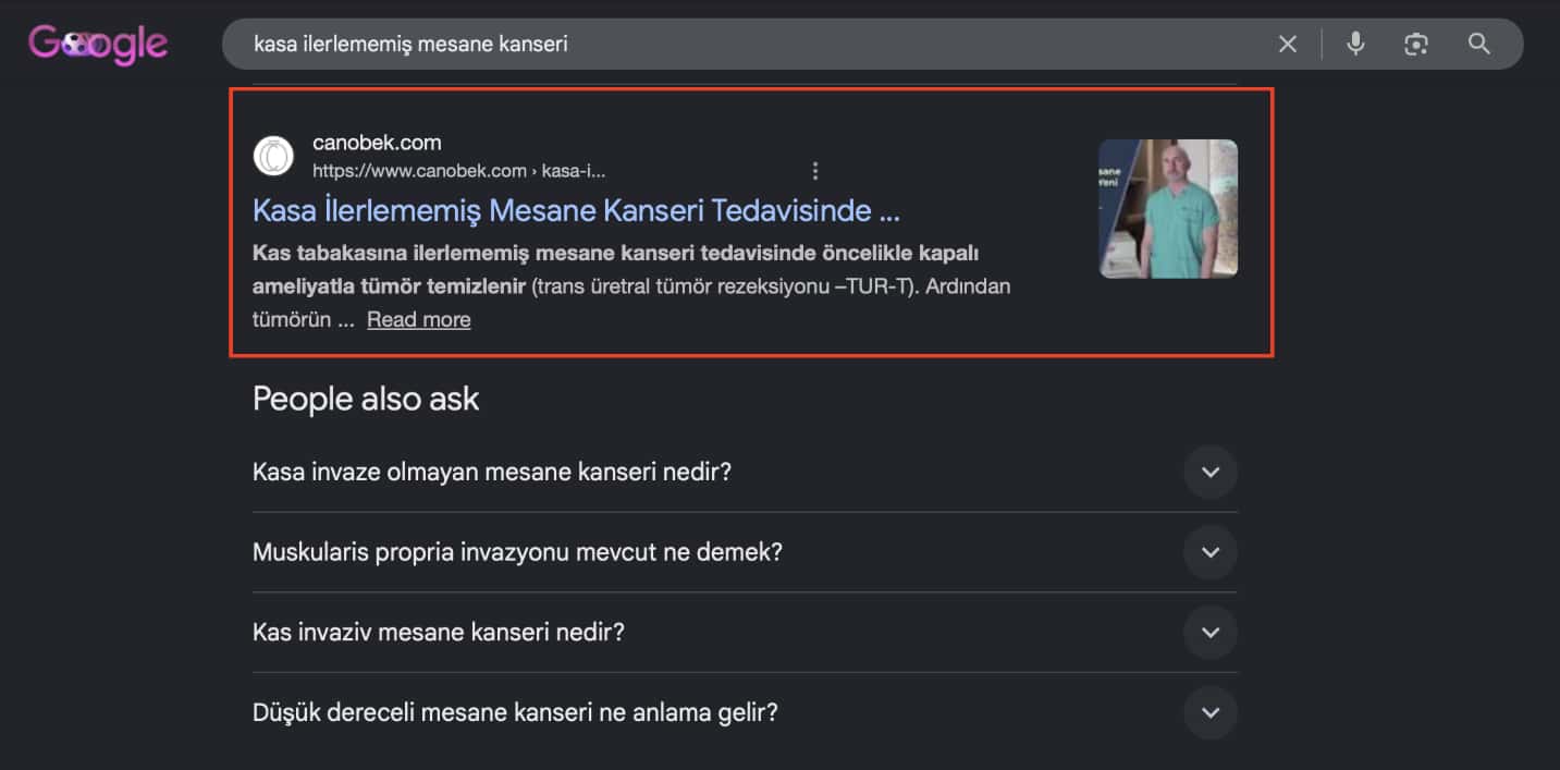 Kasa ilerlememiş mesane kanseri | e-Klinik
