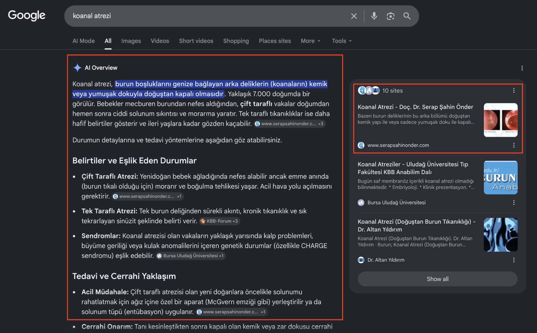 Koanal Atrezi | e-Klinik